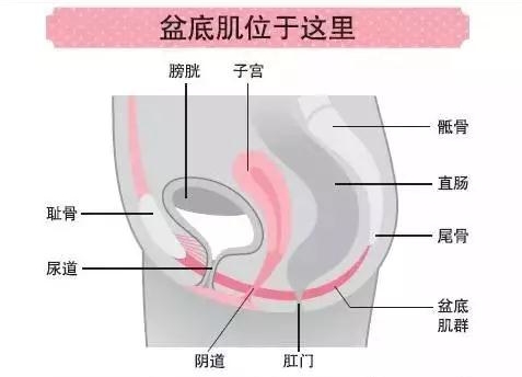 產后盆底修復