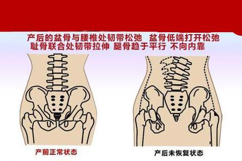 產后腰背痛