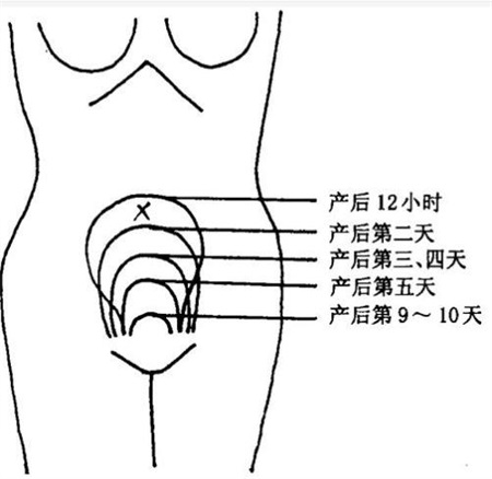 產后康復